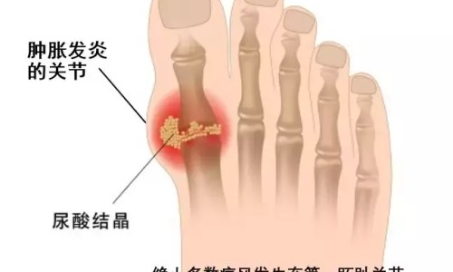 热量转化器-热量转化为脂肪网热量转化器知识网站,分享热量转化脂肪要多久大全